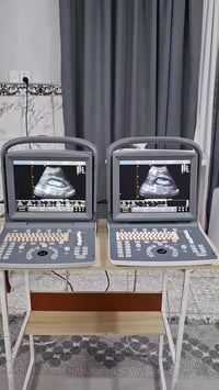 توفر أجهزة سونار بورتبل مستعملة نظيفة نوع Chison eco2 و Chison eco1 مع...