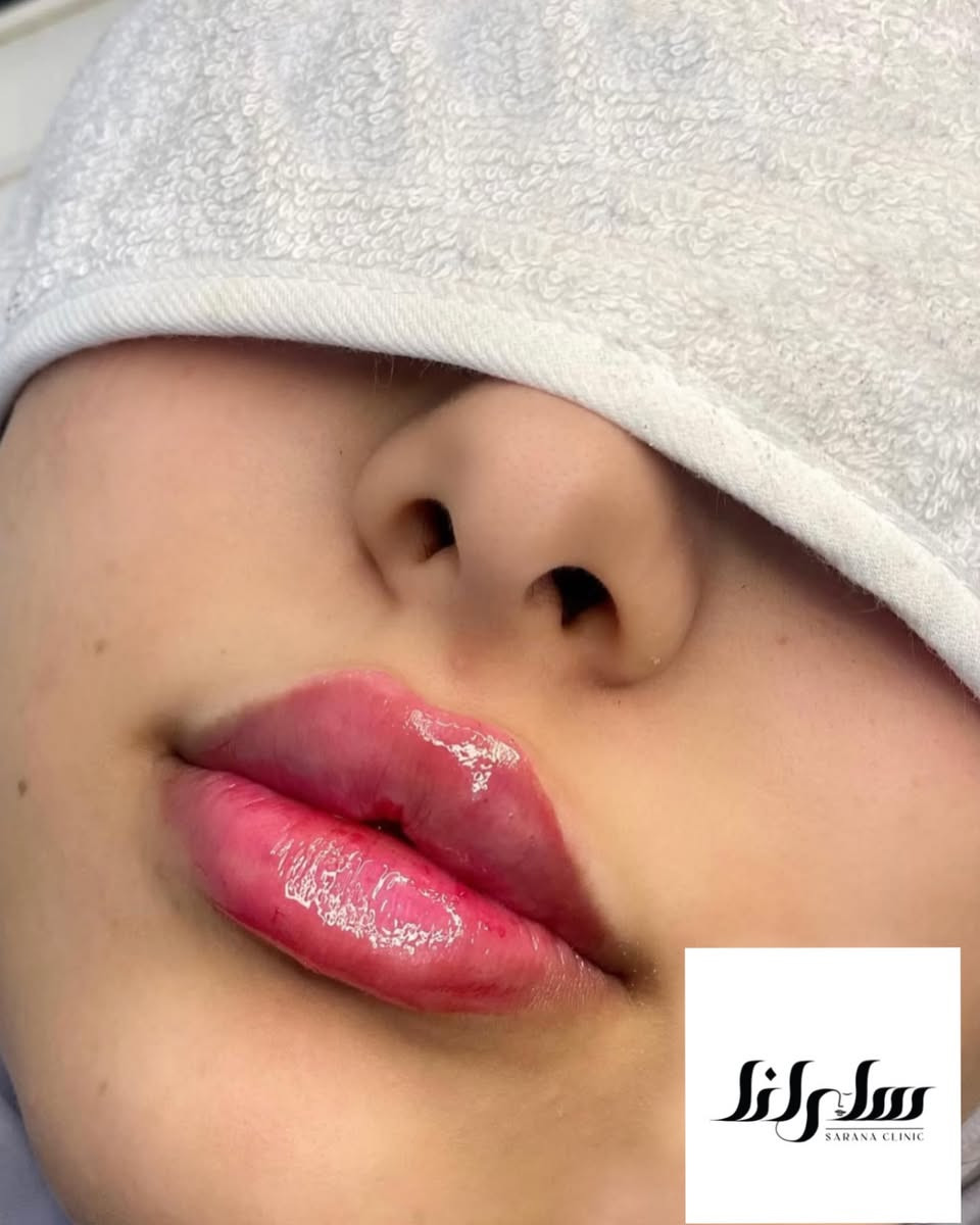 عنواننا النجف ركن السلام جامعه(الاربع شوارع) مجاور ازبري قرب يو كافيه 
للحجز ***********
