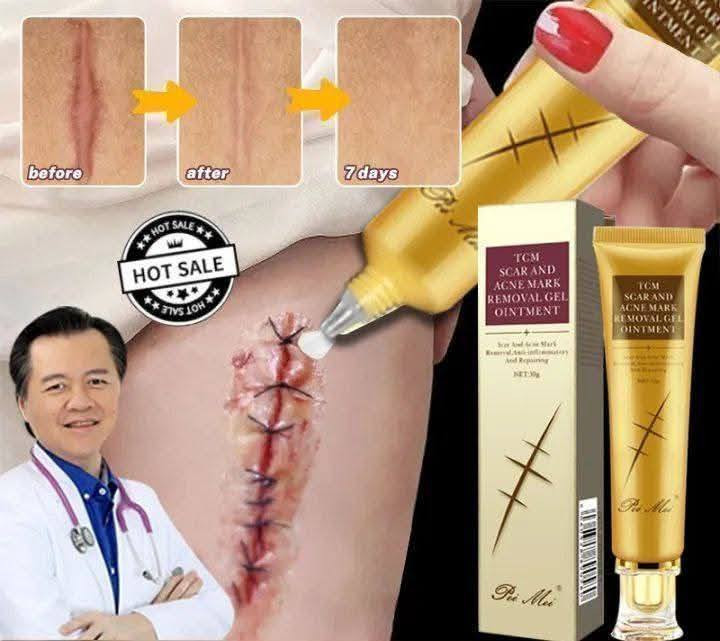 منتج بريطاني فعال لوجه كالقمر ♥️المنتج السحري لأخفاء الاثار♥️
🔥بعد الإنقطاع رجع توفر الكريم اللي كل حبو لأخفاء العيوب 
💥المنتج السحري لإخفاء جميع الندبات المزعجة العلاج الامثل لحب الشباب وأثار الحروق والجروح بكافة اشكالها
💢من اجمل ما انتجته شركة لانبينا 
💢كريم لإصلاح البشرة بوقت قياسي التأثيرات : 

✅ حفرة ناتجة عن حب الشباب 
✅ ندبات بثرة 
✅ علامات لدغ الحشرات 
✅ علامة فرك وما إلى ذلك 
✅ تساعد بشكل فعال في إزالة: الحروق ، الجروح والعلامة التي تؤثر على الجمال
✅ كريم علاج اثار العمليات القيصريه 
✅ اثار علامات التمدد اثار ندبة acnes, الجلد , الحروق

🔴 lanbena tcm وكاله بريطانيه
✅ كريم ازالة الندبة من lanbena هو كريم التكنولوجيا المتقدمة, وهو يخترق بشكل فعال الجلد و ازالة التشققات
🟥يعمل بشكل فعاال جدا على تحفيز الكولاجين بالبشرة ويعمل على محاربة علامات التمدد ايضا وازالة البقع الداكنة في وقت وجيز
#الاصلي 🇬🇧💯 🚘


**إذا كنت صاحب هذا الإعلان وتريد حذفه لأي سبب، رجاءا أرسل رسالة إلى الدعم الفني**