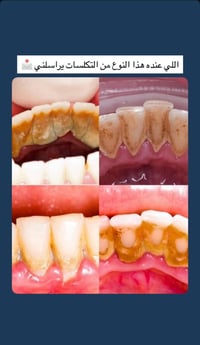 علماً أن العمل مجاناً 07714849319