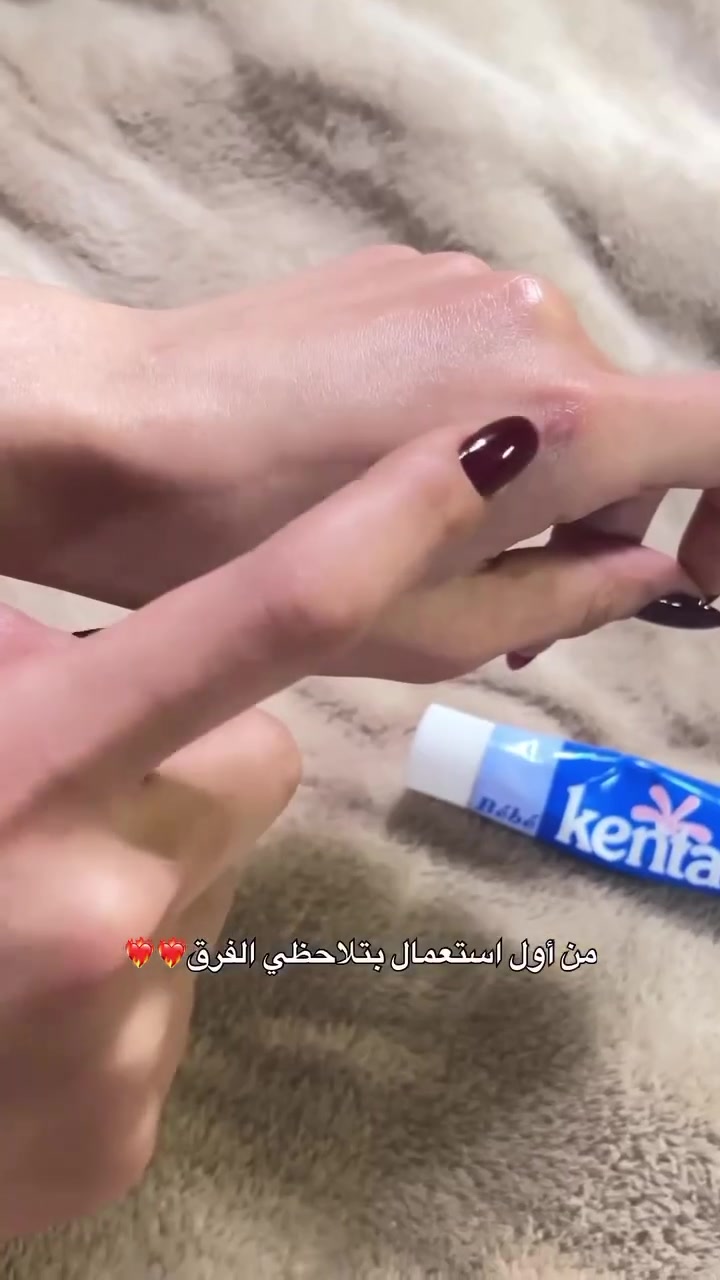 ⁨ 🔥 كريم كينتا الأصلي 🔥
✔️ تفتيح وتوحيد لون البشرة (حتى المناطق الحساسة)
✔️ ترطيب ونعومة
✔️ تهدئة الاحمرار والحساسية
✔️ مناسب حتى لبشرة الأطفال 👶
🧴 طريقة الاستخدام:
يُوضع على بشرة نظيفة ويُدلّك بلطف لحد ما يمتص

تـــــــوصيــــــ🚗ــل بغـــــداد 4 محــافظات 6

#عناية_بالبشرة #بشرة_صحية #ترطيب #تفتيح_البشرة #إشراقة تقشير_البشرة نضارة_البشرة بشرة_مثالية حب_الشباب روتين_البشرة⁩


**إذا كنت صاحب هذا الإعلان وتريد حذفه لأي سبب، رجاءا أرسل رسالة إلى الدعم الفني**
