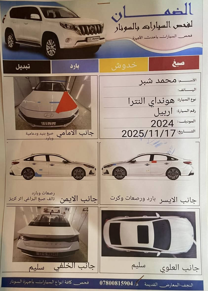 السلام عليكم ورحمة الله وبركاته
النترا 2024 ماشيه 54 السونار مرفق بالمنشور

———

المواصفات :

1️⃣ سلايد روف

2️⃣ بصمة ابواب 

3️⃣ ويل كب 17

4️⃣ مري شفط

5️⃣ لايت لد 

6️⃣ حساس امامي خلفي

7️⃣ شاشه

8️⃣ كامره

9️⃣ مري شفط

1️⃣0️⃣ لايت 3عدسات زنون

1️⃣1️⃣ كشنات جلد

1️⃣2️⃣ هند بريك بصمه

1️⃣3️⃣ تبريد خلفي 

1️⃣4️⃣ تحكم ستيرن جهتين

1️⃣5️⃣ كروز سرعه 

1️⃣6️⃣ كيلو متر دجتال 

1️⃣7️⃣ مكينه 1500 دبل نوزل

———

💰السعر : 135

 ✅ البيع نقداً وبالتقسيط وبمقدمه جيده لسكنة النجف 

للمزيد من التفاصيل الاتصال على الرقم ☎️

***********

العنوان📍 : النجف الأشرف - المعارض الجديده - 

معرض الماسه
