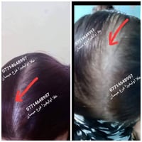 حنة الفاو • زيت تساقط الشعر • بكج مخفض