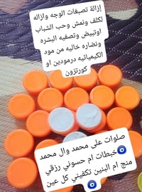خبطات • ام حسوني