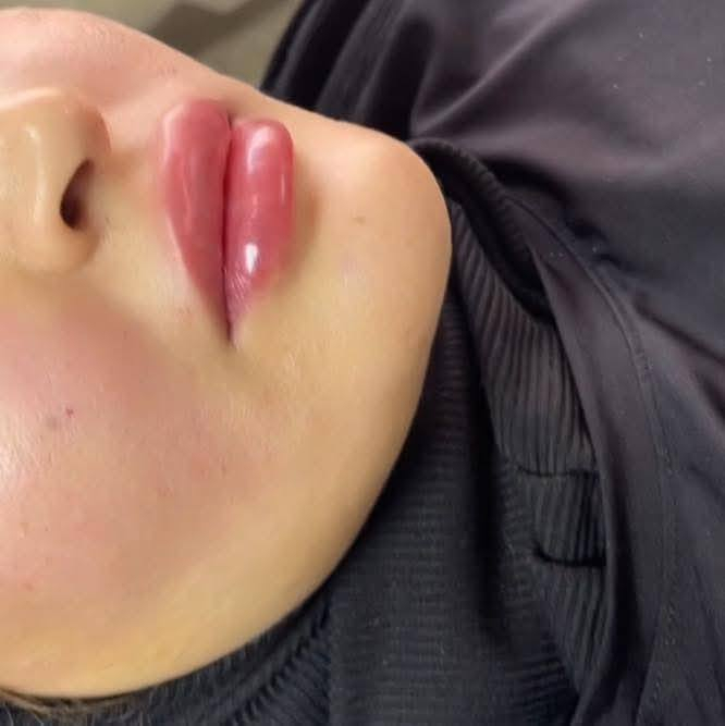 يعلن سنتر علوش  للتجميل عن عروض الفلر 🔥🔥❤️❤️
عروض راس سنه 🌲🌲🌲
 البنوتات ❤️‍🔥
كل انوع الفلر حسب ختيارج بسعر 25🤩
الفلرات (1cc)🔥💋💋💋💋💋
اراستي اي بلاس.                    (1cc)
نيوراميس تغير شامل             (1cc)
نيوراميس كوري ديب شفه     (1cc)
نيوراميس كوري فاليوم وجه   (1cc)
ميدام كوري شفه                  (1cc)
ميدام كوري وجه.                (1cc)
ابتك شفه                             (1cc)
ابتك تغير شامل.                   (1cc)
ابتك سوفت.                          (1cc)
بايوبكس وجه.                         (1cc)
بايوبكس شفه.                          (1cc)
بايوبكس سوفت.                    (1cc)
العنوان بغداد جديده نعيريه فلكة كنيسة مريم العذراء 
فرع كرزات كاجوو للحجز ☎️***********🤩
@إشارة
