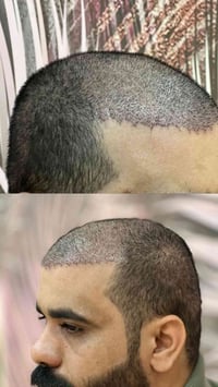 🚫الكثافة الزايدة تخرب الشكل , والقليلة تفضح الزراعة  ✅الشغل الصح هو تو...