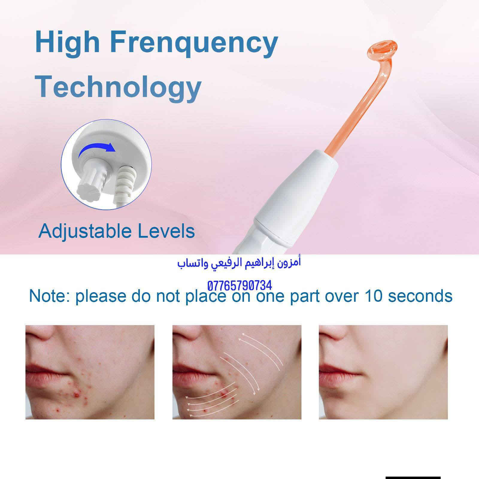 جهاز التجميل المحمول عالي التردد LZ-006A.
جهاز علاج حب الشباب: يساعد الأكسجين المنتج على قتل البكتيريا المسببة لحب الشباب وتقليل الالتهاب والاحمرار.
مكافحة الشيخوخة: يحفز الدورة الدموية وإنتاج الكولاجين والإيلاستين، مما يساعد على شد البشرة، وتقليل الخطوط الدقيقة والتجاعيد، وتحسين مرونة الجلد.
صحة الشعر: عند استخدام ملحق المشط، فإنه يحفز الدورة الدموية في فروة الرأس لتعزيز نمو الشعر ومنع تساقطه.
تحسين البشرة: يساعد على تقليل المسام المتضخمة، ويسرّع التئام الجروح، ويعزز الامتصاص الفعال لمنتجات العناية بالبشرة.
               🌹  السعر  15  الف  🌹
توصيل جميع محافظات العراق 🌟 🇮🇶 
العنوان:ذي قار _الرفاعي _الصوب الثاني فرع شركة الماء الارو 
امزون إبراهيم الرفيعي واتساب ***********
