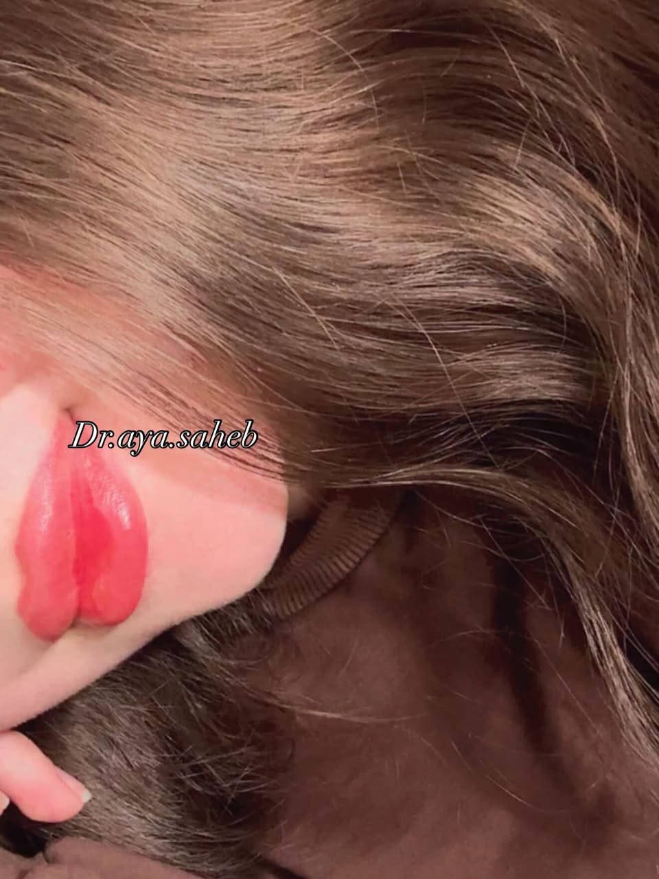 هالمرة البوست من تصوير مراجعاتي🫶🏻 رڤيو فلر الشفة لمختلف مراجعاتي حرفياً صورة احلى من صورة حرت شنو انزللكم💗💗
الديوانية 📍
للحجز/***********
