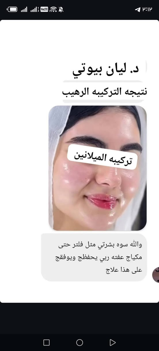 تركيبه الميلانين  الماكسس وقطراتها 🖤
تدرون بهل تركيبة
راح تحصلون ع بشرة زجاجية
معالجة حب الشباب
ازاله الكلف والتصبغات والنمش العميق ولسَطحي
توحيد لون البشره وازاله التصبغات حول الفم والعنيده
تبيض وتوريد ونعومه خياليه 🖤


**إذا كنت صاحب هذا الإعلان وتريد حذفه لأي سبب، رجاءا أرسل رسالة إلى الدعم الفني**