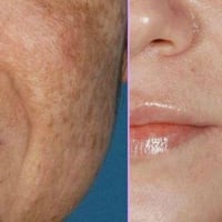 سيروم نيساميند 10 • تهدئة البشرة • تقليل آثار الحبوب