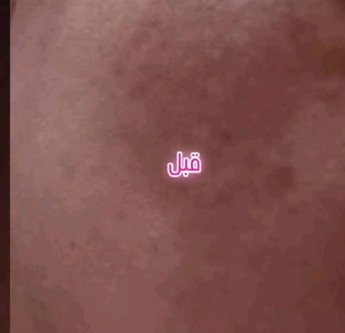 الحمد الله على نتائج كريم لارا ياسر
فديت كيكاتي احبكم 😘😘😘


**إذا كنت صاحب هذا الإعلان وتريد حذفه لأي سبب، رجاءا أرسل رسالة إلى الدعم الفني**