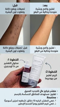 تفتيح المناطق الحساسة • ذا أوردينري • بيوديرما
