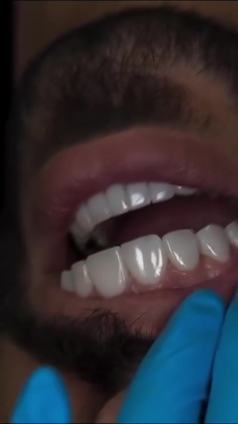 "🦷 أسنان أكثر إشراقة ويا مراكز الشركة الطبية 

في مراكز الشركة الطبية العالمية ، نوفر لك أحدث تقنيات طب الأسنان، وأسهل طرق الدفع.

✅ تقويم الأسنان ✅ تبييض الأسنان ✅ ابتسامة هوليوود
زراعة أسنان 
وحشوات وكتير من الخدمات 

متواجدين داخل المركز طيلة أيام الأسبوع لخدمتكم 

  #عيادة_اسنان #طب_اسنان #كي_كارد #KeeCard #دفع_الكتروني تقويم_اسنان تبييض_الاسنان زراعة_الاسنان ابتسامة جمال صحة

العنوان : طويريج _الشارع العام_مجاور نقابة المعلمين _مقابل المكتبة العامة _مجمع الحارث الطابق الثاني 

رقم الهاتف ***********
  ***********
