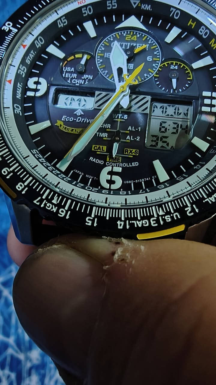 للبيع ساعة ستزن بلو انجل
ستزن موديل U 680 .جديد غير مستخدم .
السعر 500 دولار
المواصفات
ساعة سيتيزن بروماستر بلو أنجل U680 هي واحدة من أشهر ساعات الطيران الاحترافية من سيتيزن، وتتميز بأنها تعمل بتقنية Eco‑Drive التي تعتمد على الطاقة الضوئية ولا تحتاج إلى بطارية تقليدية. الحركة الداخلية هي U680، وهي حركة متقدمة تدعم استقبال إشارات الاقمار الراديوية لضبط الوقت تلقائياً بدقة عالية في عدة مناطق حول العالم.
التفاصيل الكاملة للمواصفات:
تعمل بالطاقة الشمسية عبر تقنية Eco‑Drive مع احتياطي طاقة طويل الأمد.
مزودة بنظام Atomic Timekeeping لاستقبال إشارات الراديو وضبط الوقت تلقائياً في الولايات المتحدة، أوروبا، اليابان، والصين٫ والشرق الاوسط .
تدعم التوقيت العالمي لـ 43 مدينة بالإضافة إلى توقيت UTC.
تحتوي على كرونوغراف بدقة 1/100 ثانية يمكنه القياس حتى 24 ساعة.
مزودة بمؤقت عد تنازلي وتقويم دائم لا يحتاج إلى تعديل حتى نهاية القرن.
تعرض الوقت عبر مزيج من العقارب التقليدية مع شاشات رقمية مزدوجة لزيادة وضوح المعلومات.
مؤشر احتياطي الطاقة يظهر على المينا لمتابعة حالة الشحن.
مقاومة للماء حتى 200 متر، مما يجعلها مناسبة للسباحة والغوص .
الهيكل مصنوع من الفولاذ المقاوم للصدأ مع زجاج سافاير كريستال مقاوم للخدش.
الحزام متوفر إما من الفولاذ المقاوم للصدأ او الجلد .
تصميم خاص مستوحى من فريق الاستعراض الجوي الأمريكي Blue Angels، بألوان الأزرق والأصفر مع شعار الفريق محفور على خلفية الساعة.


**إذا كنت صاحب هذا الإعلان وتريد حذفه لأي سبب، رجاءا أرسل رسالة إلى الدعم الفني**