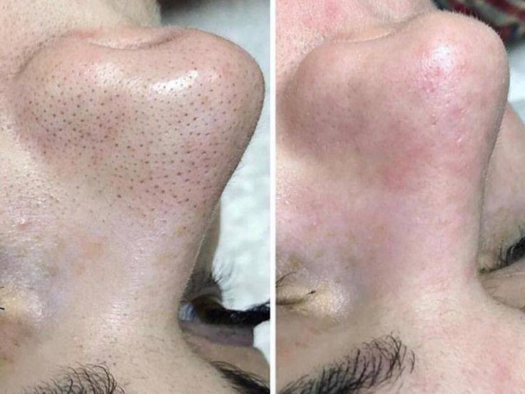 اهلا وسهلا   رمضان كريم عروض  نار
عروض مميزه💃🏻🎊
اسعارناً مناسباً 📍✨
عروض العيد
اوقات العمل خلال فترة رمضان 
من وره صلاة الضهر وبعد افطار
عروس حنه وزفه 200💃🏻💃🏻💃🏻
فقط زفه 100🎈💃🏻
فقط حنه 75🎎🔥🎉🎊🎈💃🏻
المدعوات 20🎊💃🏻🎈🎈
تنظيف البشرة هايدرو 5ب💃🏻🎊
تنظيف البشرة ملكي ب20🎉
تنظيف  اليد 5🥳💃🏻💃🏻💃🏻💃🏻💃🏻
حفافة 5
شمع للوجه  7
بديكير 10مع املاح طبيعية 
الماكير 25🎈🎈🧸
سحب لون شعر قصير 10 واسط 15فما فوق حسب طول الشعر
صبغ شعر قصير جداً 15💃🏻🎎🔥المتن 25لوسط 40 الطويل حسب طول الشعر 
ميش كثيف قصير 20 فما فوق حسب طول الشعر 🎎🔥💃🏻
تسريح الشعر يخلي شعرج سرح حسب طول الشعر 
قص 5 اي قصه 
معالج لترميم وتغذية الشعر القصير 20 فما فوق حسب طول الشعر🎉🎊🎈
اهلا وسهلا بلجميع 
صالون الين
العنوان//كربلاء حي الرباب قرب سيد سماعيل 
الحجز //***********
***********
