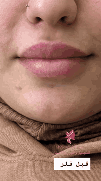 عيادة فلورا • فلر شفه • طوز سوك الجمهوريه