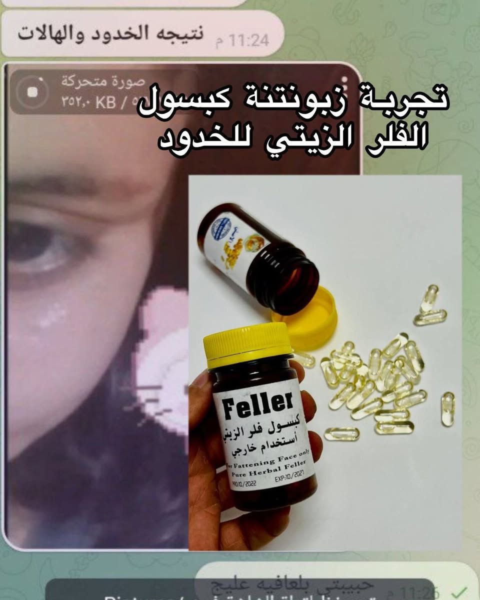 كبسول الفلر الزيتي لأمتلاء الوجة والخدود
جداً أمن امريكي وعشبي 🤏🏻🥹💗
بنات هذا المنتج✨يـنفخ الخدود، يفتح البشرة، وينطيج نضارة تخبّل من أول استخدام 🤍
كله أعشاب وفيتامينات 💊🌿 وآمن ١٠٠٪ حتى للحامل والمرضعة ومرضى السكر والضغط 👌🏻
✨ شنو يسوي؟
• ينفخ الوجة والخدود طبيعي من غير أبر ولا عمليات 
• يفتح من 1 إلى 7 درجات ويوحد لون البشرة 
• يزيل الخطوط الرفيعة تحت العين ✨
• ينعم البشرة ويخليها صافية  🫶🏻
🧴 طريقة الاستخدام :
تفتحين الكبسولة وتدلكين الزيت على الوجة زين، وتغسلينه الصبح 🌞

توجد توصيل لجميع المحافظات العراق 🇮🇶🚚🚕للحجز والاستفسار يرجى التواصل عبر الخاص 📩💌توجد لدينا عروض خاصة وخصومات وهدايا 🎁😍
@إشارة


**إذا كنت صاحب هذا الإعلان وتريد حذفه لأي سبب، رجاءا أرسل رسالة إلى الدعم الفني**