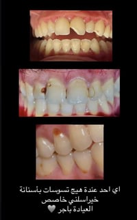 07847849790 يتواصل وياي هنا او على الخاص 🩶