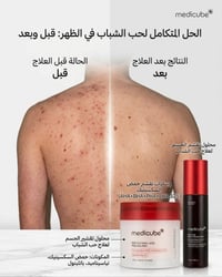 توصيل المحافظات • منتجات أصلية • تفتيح البشرة