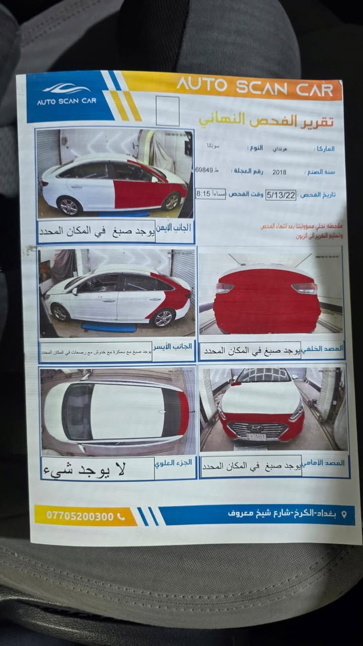 سوناتا وارد أمريكي موديل 2018 سيارة احلى من الصور ليبل واحد حادثها واضح سونار واضح السعر ابلاش 115 وبيه مجال قليل حك جيه
للتواصل 
***********
عنوان ديالى ناحية جديدةً الشط
