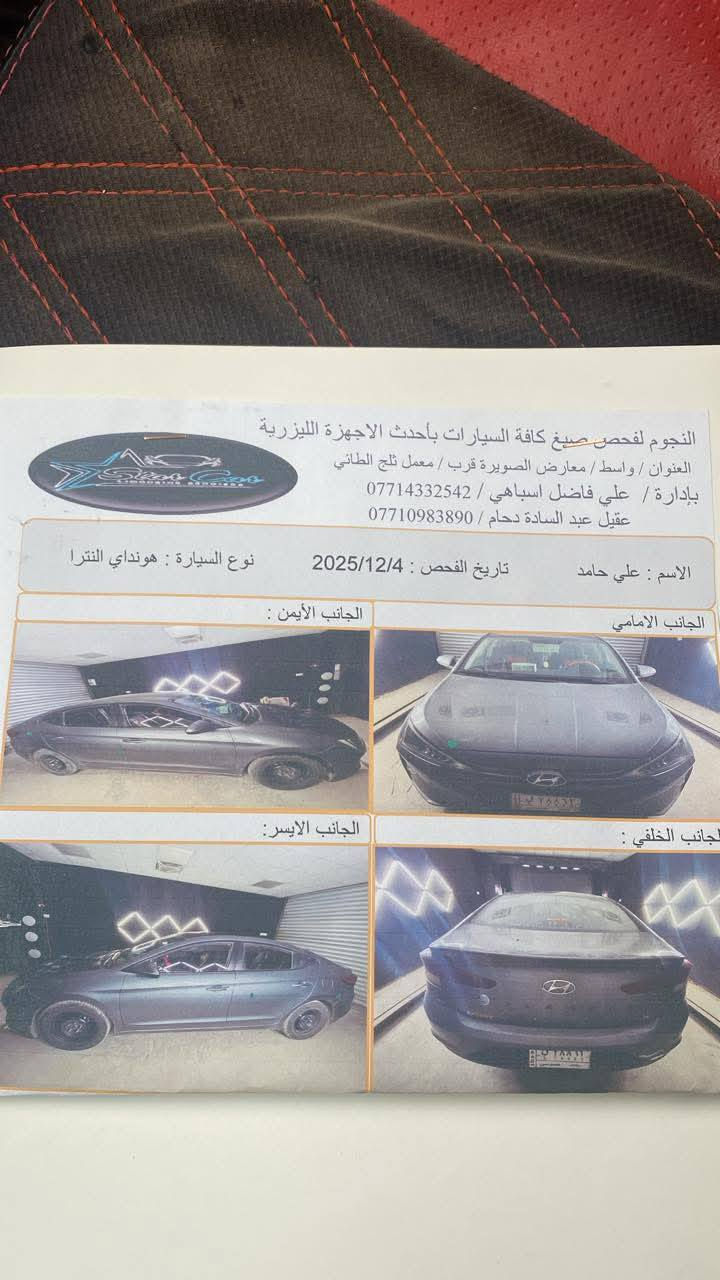 كفاله خليجي 2019 رقم جديد بسمي سياره حيل حلوه لد نهاري داخل جلد بلادي سعر 125 رقمي ***********
