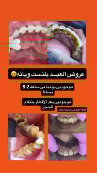 عروض العيد • حجز مسبق • الحصوه حي الانوار