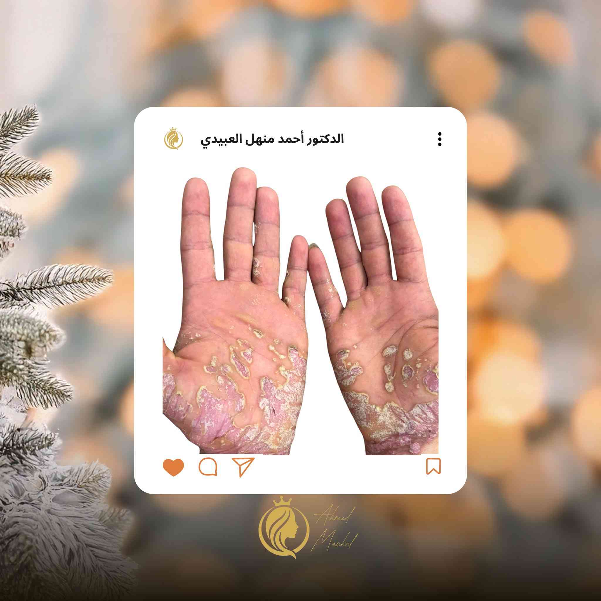 العلاج الصحيح يبدأ بتشخيص مبني على علم وخبرة.
قرارات طبية دقيقة لا تترك مجالًا للتجربة.
هنا تُدار الحالات بثقة،
لأن النتيجة مسؤولية وليست احتمالًا.

عيادة الدكتور أحمد منهل العبيدي
📍 مجمع البرج الأبيض – حي البريد
📞 ***********
📞 ***********
