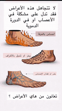 تشكي من الالام او خدر او تنمل في الاطراف ؟!!    اكتبولنة بالتعليقات⬇️⬇...