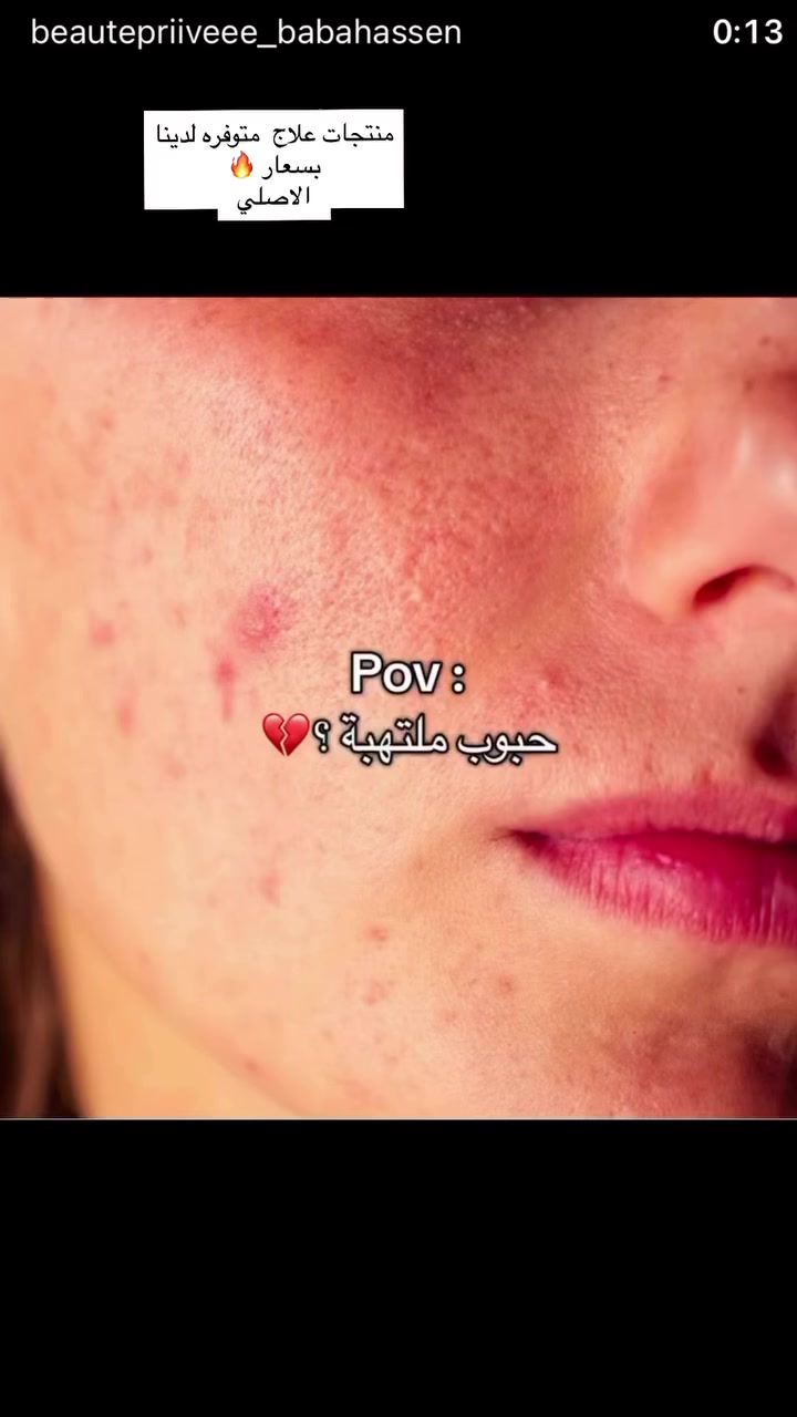 منتجات اصلية بأسعار مناسبة 🔥
العنوان بابل المدحتيه سوق الذهب 
سيد كرار


**إذا كنت صاحب هذا الإعلان وتريد حذفه لأي سبب، رجاءا أرسل رسالة إلى الدعم الفني**