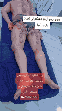 طوز خورماتو بيت العافية للمساج طبيعي وحجامة ( *********** )
