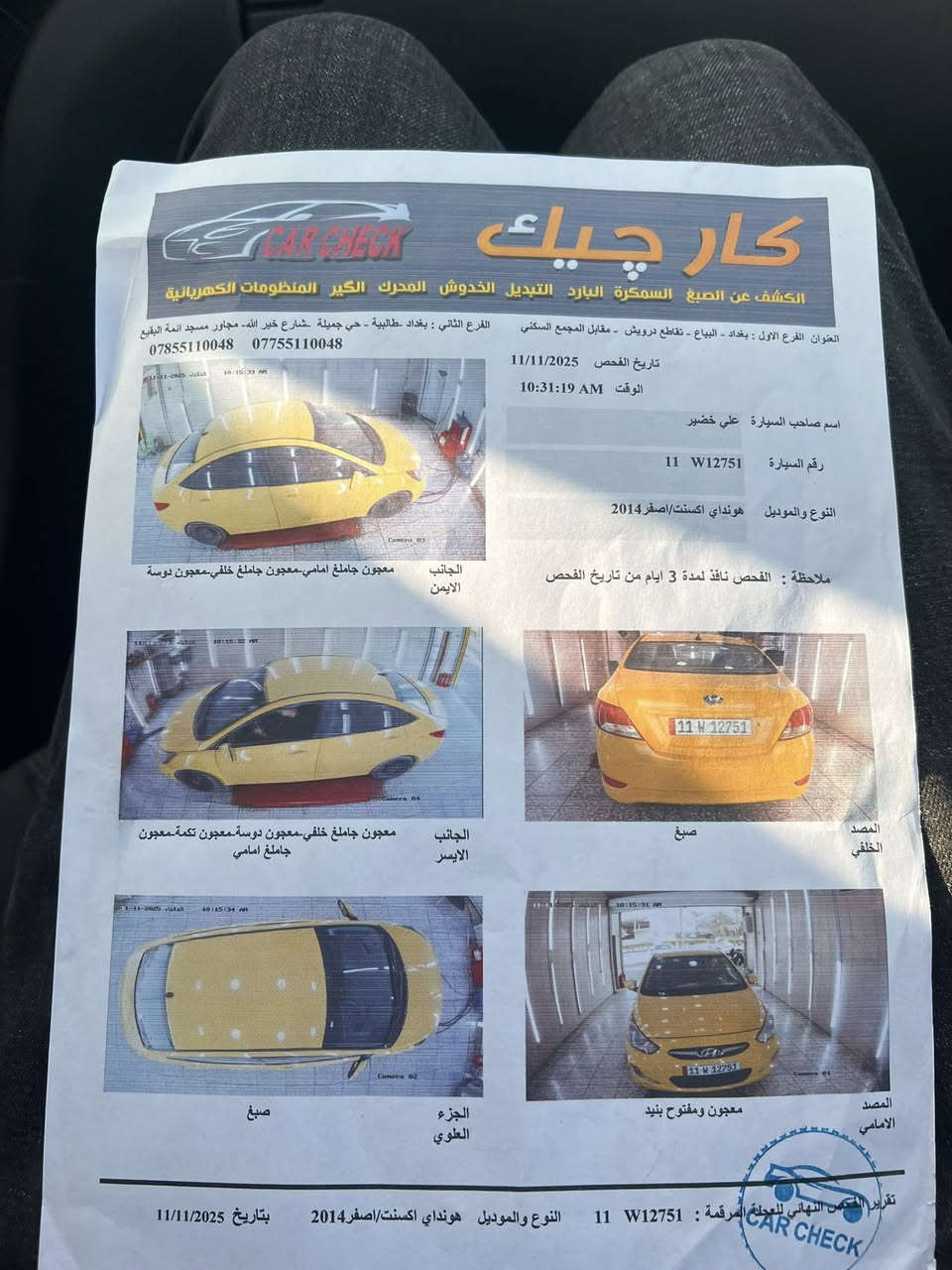 سلام عليكم اكسنت ٢٠١٤ كندية كفالة عامة مكينة ١٦٠٠ بيها خيط بخار رقم بغداد  بسمي  عنوان البلديات مكلف بل نشر رقم صاحب سيارة ***********. السونار مرفوق داخل المنشور
