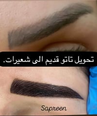 تحويل تاتو قديم الى شعيرات مكثفة للحجز والاستفسار مراسلة البيج او الوا...