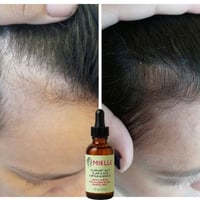 زيت اكليل الجبل • شعر تالف • توصيل لجميع المحافظات