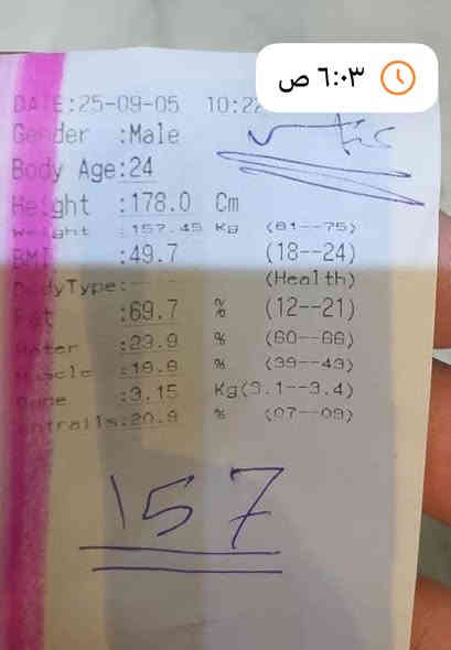 ضايج من وزنك ؟؟
دتحلم بجسم ووزن مثالي وتحسه صعب 
ويانا ماكو  شي صعب أنت تحلم وأحنى نحققلك أحلامك 
وبكل أمان وبمتابعة على  مدار 30 يوم 
نسويلكياها سفرة يوم أجمل من يوم
🔻🔺
ويانه إطمئن وأحلم بالوزن اليعجبك
وإحلامك أوامر 
💥  صيدلية شارع 40 💥

#للحجز_أو_الأستفسار_يرجى_مراسلة_البيج
#او_الواتساب🩵***********🩷
العنوان:بابل-حلة-شارع 40 -بداية -باب الحسين-مقابل-دائرة-الكهرباء-ومجاور-BDC-مول 
توجد خدمة توصيل لكل محافظات العراق
@أبرز المعجبين
