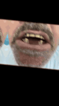 تعويض الاسنان بالجسور وتجميلها او بالتغليف الزاركون مع الضمان 
ويوجد عرض بنظام الاقصاد 

للتواصل راسلونا واتساب ***********

عيادة الدكتور محمد الخفاجي في حي النور قرب عيادة سيد حبيب التمريضية ومجاور للصيدلية
