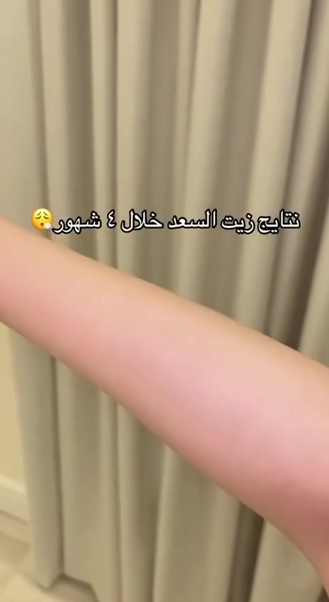 ✨ زيت السعد الأصلي ✨
للبشرة الناعمة والعناية بعد إزالة الشعر 💚
سهل الاستخدام ونتائجه تفرق مع الاستمرار 🌿
للطلب والاستفسار راسلينا 📩
#زيت_السعد #عناية_بالبشرة #جمال #العناية_الشخصية #بشرة_ناعمة #منتجات_تجميل #كوزمتك_فراشة #العراق #بغداد #اكسبلور #fyp #foryou #viral #trending #reels #tiktokiraq


**إذا كنت صاحب هذا الإعلان وتريد حذفه لأي سبب، رجاءا أرسل رسالة إلى الدعم الفني**