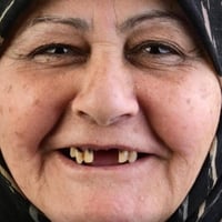 المختبر الفني السوري  لصناعة الاسنان و التعويضات السنية وتركيب الأسنان...