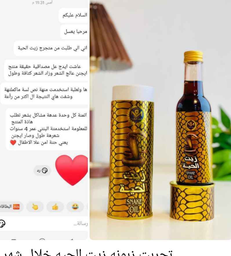 🐍 زيت الحية المغربي الاصلي MG 🐍

مكون من زيت الحيه الاصلي مضاف له
 مجموعه زيوت اصليه وفيتامينات لكي
 تزيد وتتضاعف فعاليته لعلاج جميع مشاكل الشعر
توقف التساقط باول استعمالين او 3☺️
فوائد المنتج.....
⬅️ إيقاف تساقط الشعر خلال فترة قصيرة جدا
⬅️ تقوية بصيلات الشعر من جذوره
⬅️يعطي نظارة للشعر تفوق اغلب مستحضرات التجميل
⬅️يعمل على اطالة الشعر بشكل ممتاز
⬅️ يعمل على تكثيف الشعر بفتره قصيرة جدا
*يمكن استخدامه من من قبل النساء والرجال
المنتج طبيعي ١٠٠٪؜ ومضنع وفق
 المواصفات العالميه من شركه الذهب المغربي MG

طريقة الاستخدام 😍
✅توضع على فروة الشعر ليلا مع التدليك
 لمدة ٢-٣دقائق وتغسل في الصباح

السعر :: 15 الف وتوصيل مجاني بغداد, العراق


**إذا كنت صاحب هذا الإعلان وتريد حذفه لأي سبب، رجاءا أرسل رسالة إلى الدعم الفني**