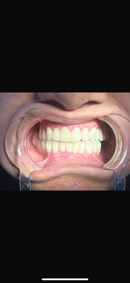 ✨ عيادة الدكتورة سميرة مهدي جاسم لطب الأسنان ✨

ابتسامتك أجمل معنا 😍

📢 عروض وتخفيضات خاصة لفترة محدودة:
🦷 تخفيض على حشوات الأسنان
🦷 تخفيض على تنظيف وتلميع الأسنان
🦷 أسعار مميزة لعلاج العصب
🦷 استشارات وفحص بأسعار مناسبة

✔️ عناية متكاملة بأحدث الأجهزة
✔️ جودة ودقة في العلاج
✔️ راحة واهتمام بكل مريض

📍 للحجز والاستفسار يرجى التواصل عبر الهاتف *********** أو زيارة العيادة. في الدورة بداية هور رجب مقابل افران الزيتون

🌟 اغتنم فرصة التخفيضات واحصل على ابتسامة صحية وجميل
