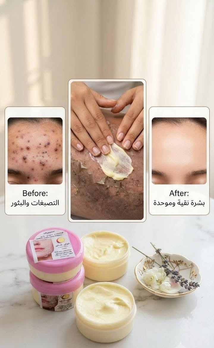 الوجبة الإيرانية الأصلية الأكثر طلباً للشعر والبشرة وصلت الآن! 😍 صفي بشرتكِ وعالجي شعركِ بأقوى المنتجات:
يمكنكِ الآن طلب أي منتج بشكل منفصل، أو استغلال العرض الأكبر للحصول على التوصيل المجاني والهدية! 👇
📦 أسعار المنتجات المفردة:
🪮 بكج الشعر الإيراني المتكامل: (الزيت المكثف لعلاج التساقط وإنبات الفراغات + التونر المنعش + علبة التمشيط الخاصة + كاب الشعر) 👈 بسعر 25 ألف دينار فقط (تضاف أجور التوصيل).
🧴 مقشر تروي شحان الأصلي (Gory Skin): لعلاج الكلف، التصبغات، آثار الحبوب، وتفتيح المناطق الحساسة والكوع والركب 👈 بسعر 15 ألف دينار فقط (تضاف أجور التوصيل).
🔥 العرض المزدوج والمدمر (إذا أخذتِ الاثنين معاً):
عند طلبكِ (بكج الشعر + المقشر الإيراني) معاً، ستحصلين فوراً على:
🚚 توصيل مجاني بالكامل لكافة محافظات العراق!
🎁 هدية مميزة ومجانية من الصفحة مرافق للطلب!
💡 وفري أجور التوصيل واكسبي الهدية مع أقوى كورس متكامل للعناية من الجذور حتى أطراف الأصابع!
📥 الكمية محدودة جداً وخاضعة للنفاذ! للحجز أرسلي رسالة خاصة للصفحة الآن أو اتركي تعليقاً وسيتواصل معكِ الدعم فوراً.
🚀 الهاشتاغات:
#جوري_سكين_الايراني #تروي_شحان #عرض_خاص #توصيل_مجاني #هدية_مجانية #علاج_التساقط #علاج_الكلف #تفتيح_البشرة #بكج_الشعر #اكسبلور_العراق #بنات_العراق #العراق_بغداد_البصرة #تجميل@جوري سكين الايراني 2


**إذا كنت صاحب هذا الإعلان وتريد حذفه لأي سبب، رجاءا أرسل رسالة إلى الدعم الفني**