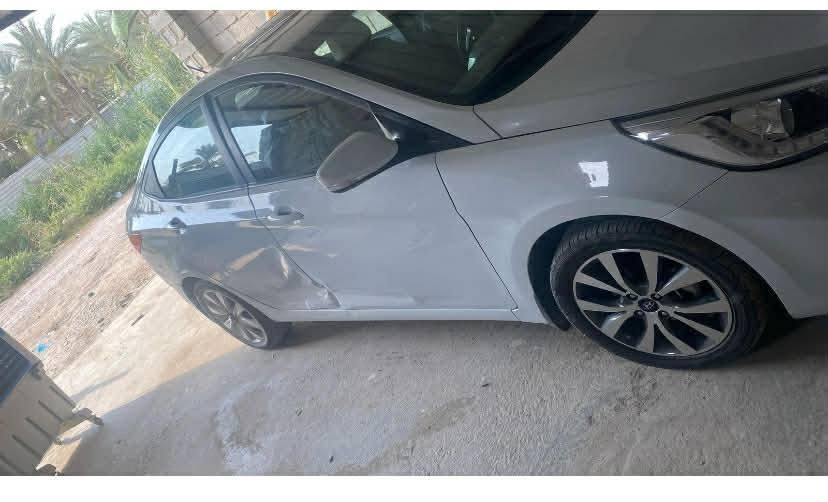 السلام عليكم اكسنت 2018 خليجي للبيع صور السيارة مرفقة بالمنشور
السيارة تخبل والضربة مرفقة بالصورة... بالباب الخلفي الي عكس السايق
اما الباقي السيارة مكفولة وكلين(كير ومحرك وكلشي... الي اخره باقي البوب وكلشي بيها تمام
علما صاحب السيارة دكتورة موظفة
اني مكلف بالنشر للتواصل
***********
مكان السيارة اليوسفية /بغداد
