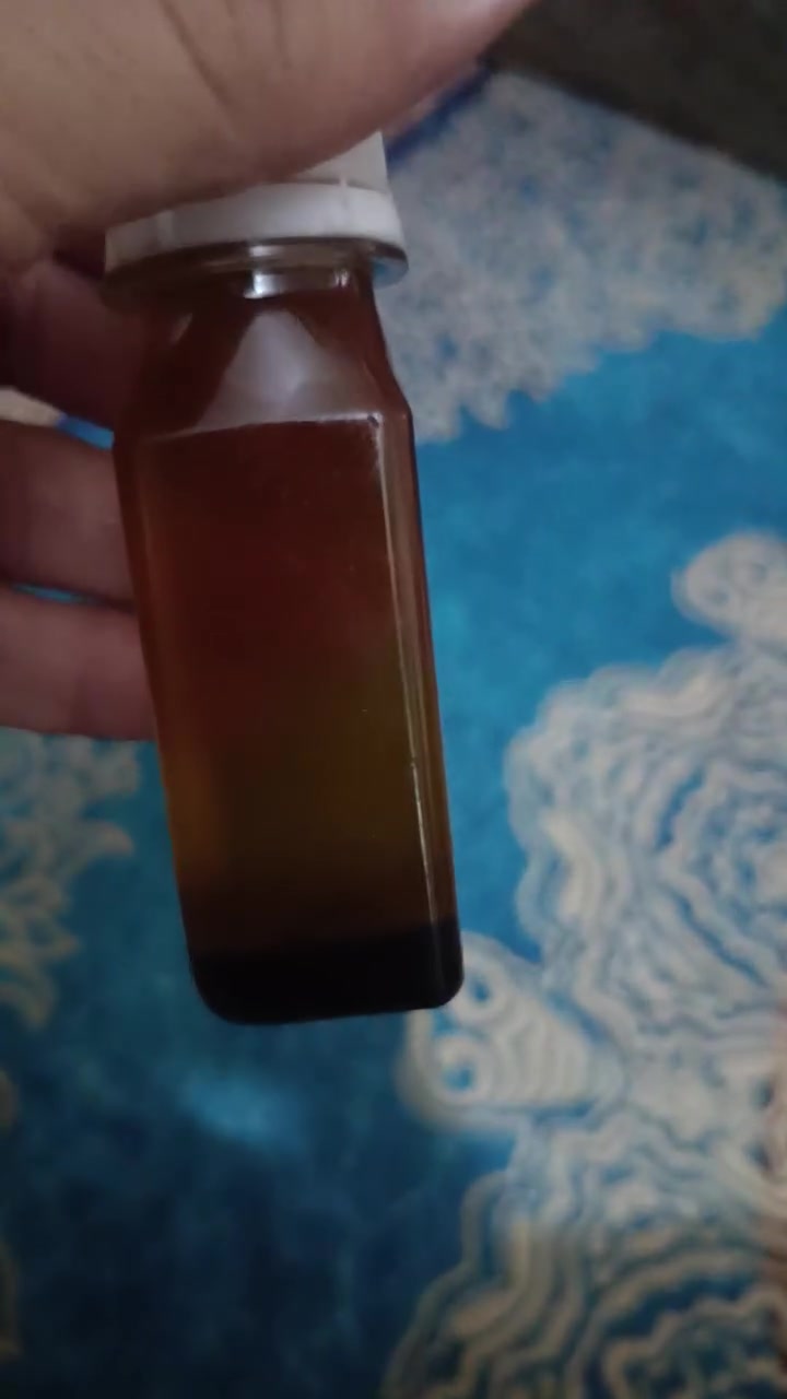 واسعار مناسبه مناسبه زيوت طبيعيه 100%


**إذا كنت صاحب هذا الإعلان وتريد حذفه لأي سبب، رجاءا أرسل رسالة إلى الدعم الفني**