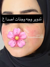 تدروير وجه • بلفلر • ناصريه