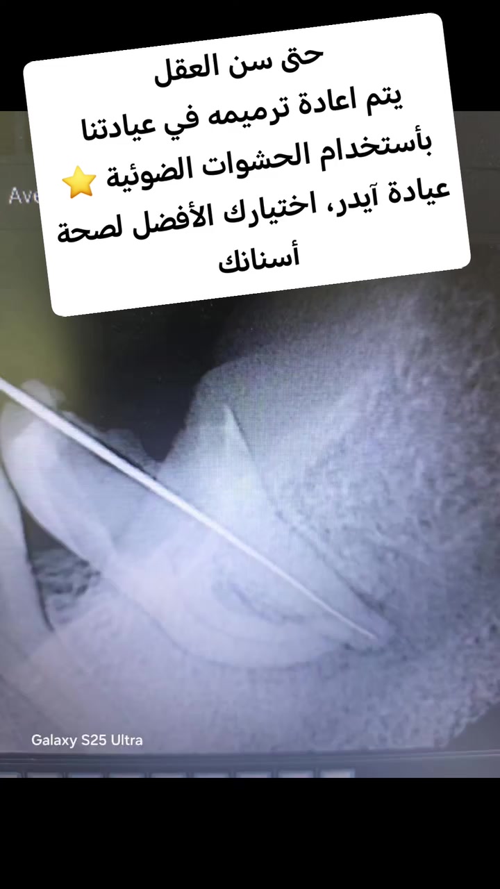 للحجز والاستفسار /***********
