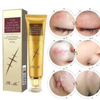 إخفاء العيوب • ندبات قيصرية • توصيل جميع المحافظات