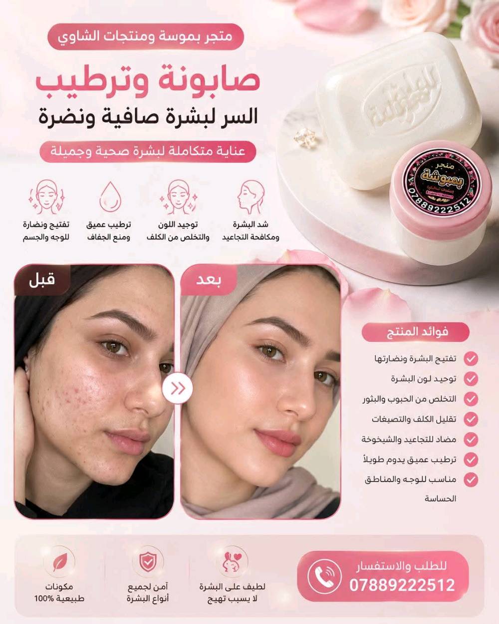 قسمًا بالله فرق واضح من أول استخدام وداعًا للحبوب ✨ الكلف ✨ التصبغات ✨  وشحوب البشرة -وكلشي مضر 
صابونة + دهن خبطة العناية من متجر بموشة ومنتجات الشاوي 💛
✅ تبييض ونضارة✅ توريد الوجه والمناطق الحساسة✅ شد البشرة وتقليل التجاعيد✅ ترطيب عميق ولمعة صحية✅ تخفيف آثار الحبوب والكلف✅ نتائج تلاحظها بنفسك
💯 مناسبة للبنات والشباب💯 مكونات آمنة ولطيفة على البشرة فرق من اول 3 ايام 
الك حق اترجعها اذا ماشتغلت بعد 7 ايام وتخابرنه وتدلل - اصلي فقط اصلي
📞 للحجز والاستفسار***********
الجمال يبدأ من العناية الصحيحة ✨ 
توضيح اكثر داخل الصور شوفو واقرو 👇 

#متجر_بمبوشة
#منتجات_الشاوي