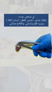 اي شخص عنده (بقايا جذور ، ضرس العقل ظاهر بشكل كما ، اسنان تالفة ) ويري...