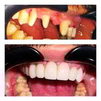 تجميل أسنان • عيادة البدر • البدير