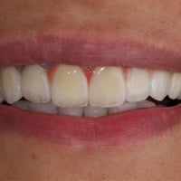 ابتسامة المشاهير لمراجعتنا    بيد الدكتور محمد حسن عقيل القريشي  للحجز...