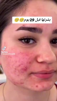 صابون جانوزي • طبيعي • تفتيح البشرة